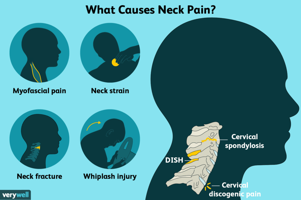 Symptoms and Causes of Neck Pain